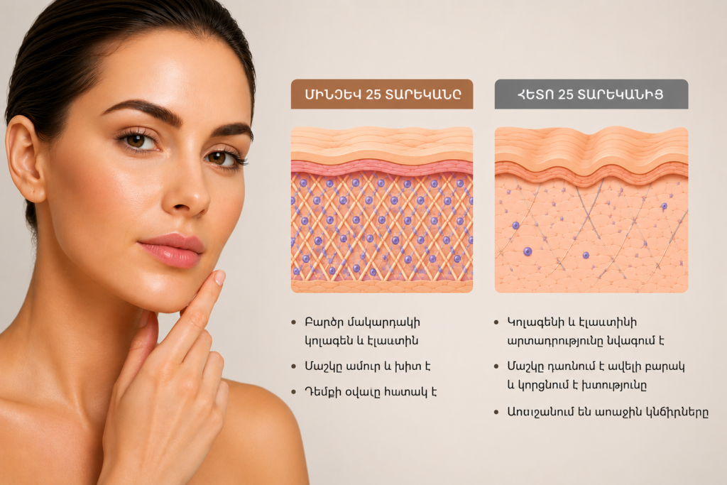 Պոլի-L-կաթնաթթուն (PLLA)