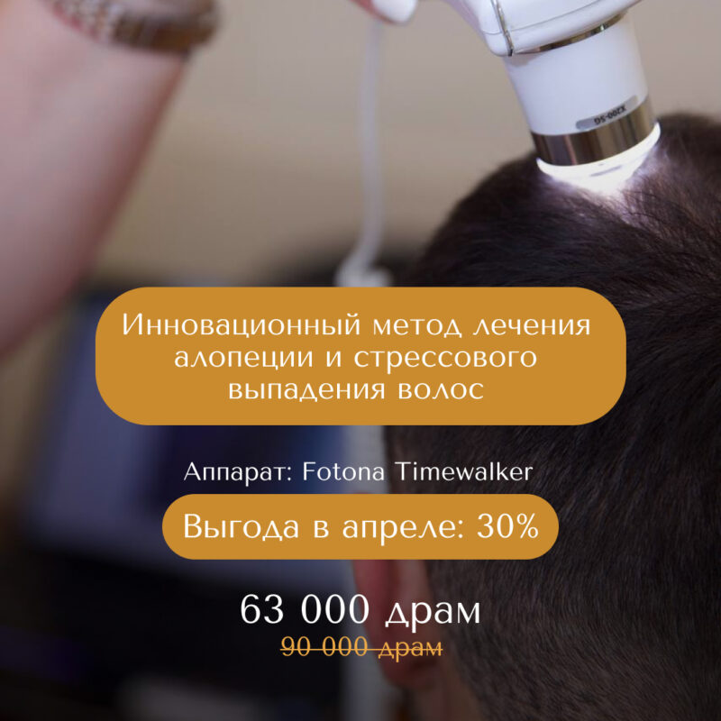 Лазерное лечение волос со скидкой -30%