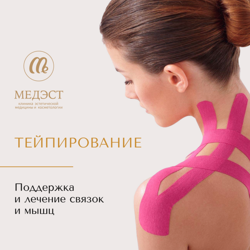 Тейпирование